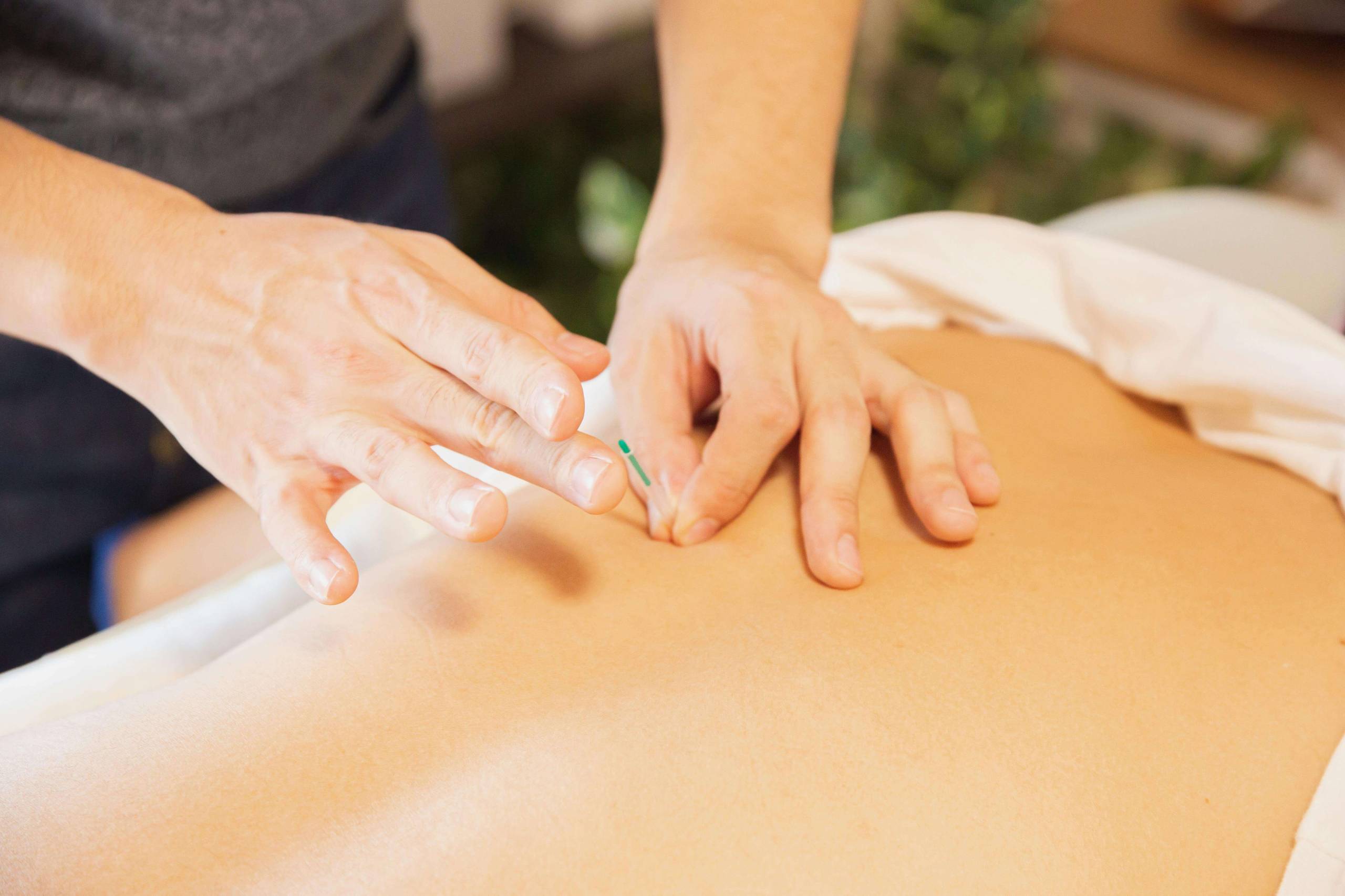 Acupuncture, Tuina massage, Moxibustion